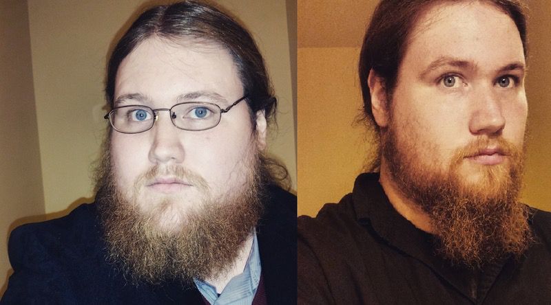 130 lbs Fat Loss Before and After 6 foot 4 Male 420 lbs to 290 lbs