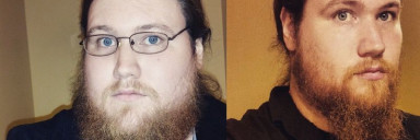 130 lbs Fat Loss Before and After 6 foot 4 Male 420 lbs to 290 lbs
