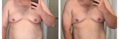 Progress Pics of 60 lbs Weight Loss 6 feet 1 Male 325 lbs to 265 lbs