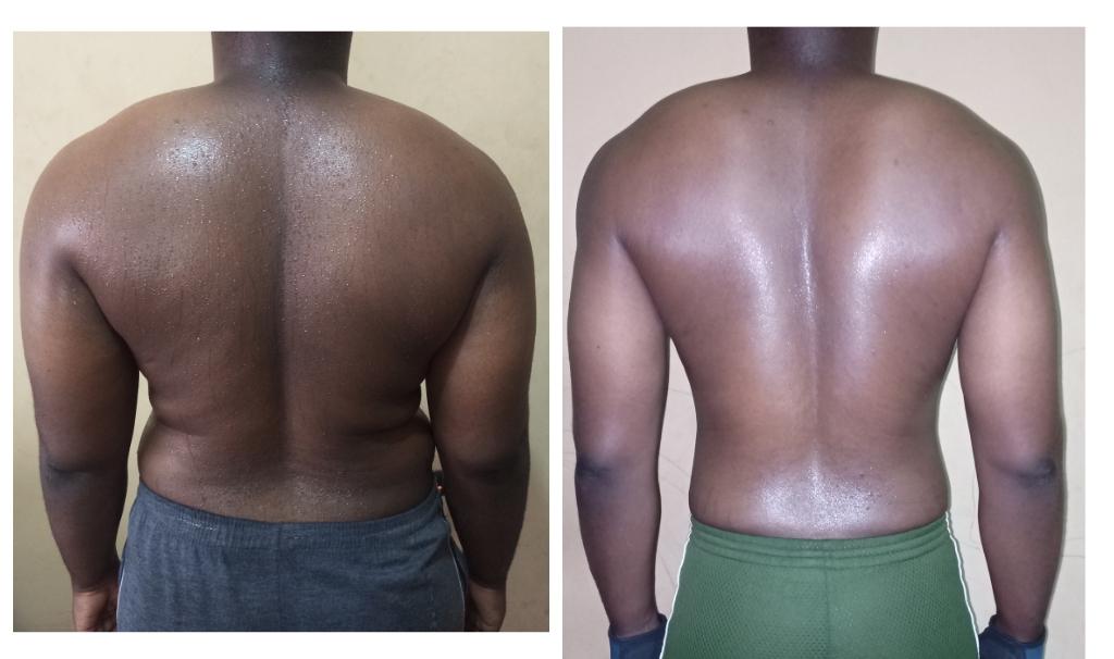 50 lbs Fat Loss Before and After 5 feet 6 Male 205 lbs to 155 lbs