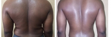 5 foot 6 Male Before and After 50 lbs Weight Loss 205 lbs to 155 lbs