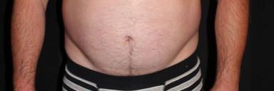 4 Pictures of a 255 lbs 5'10 Male Weight Snapshot