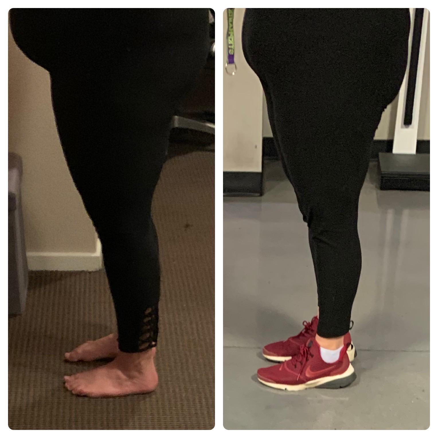 44 lbs Weight Loss 5 feet 7 Female 280 lbs to 236 lbs