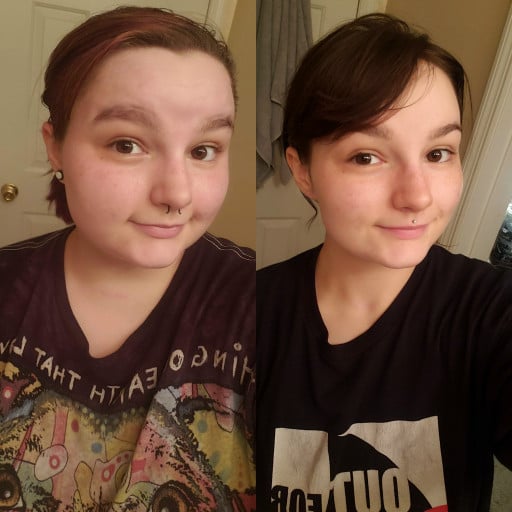 F/22/5'3" [210lbs > 135lbs = 75lbs] (about 2 years & 6 months) face gains! sometimes I feel like I look the same now as when I was 200lbs, but pictures like this help remind me that I am making real progress!