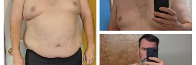 Progress Pics of 84 lbs Weight Loss 6 feet 3 Male 402 lbs to 318 lbs