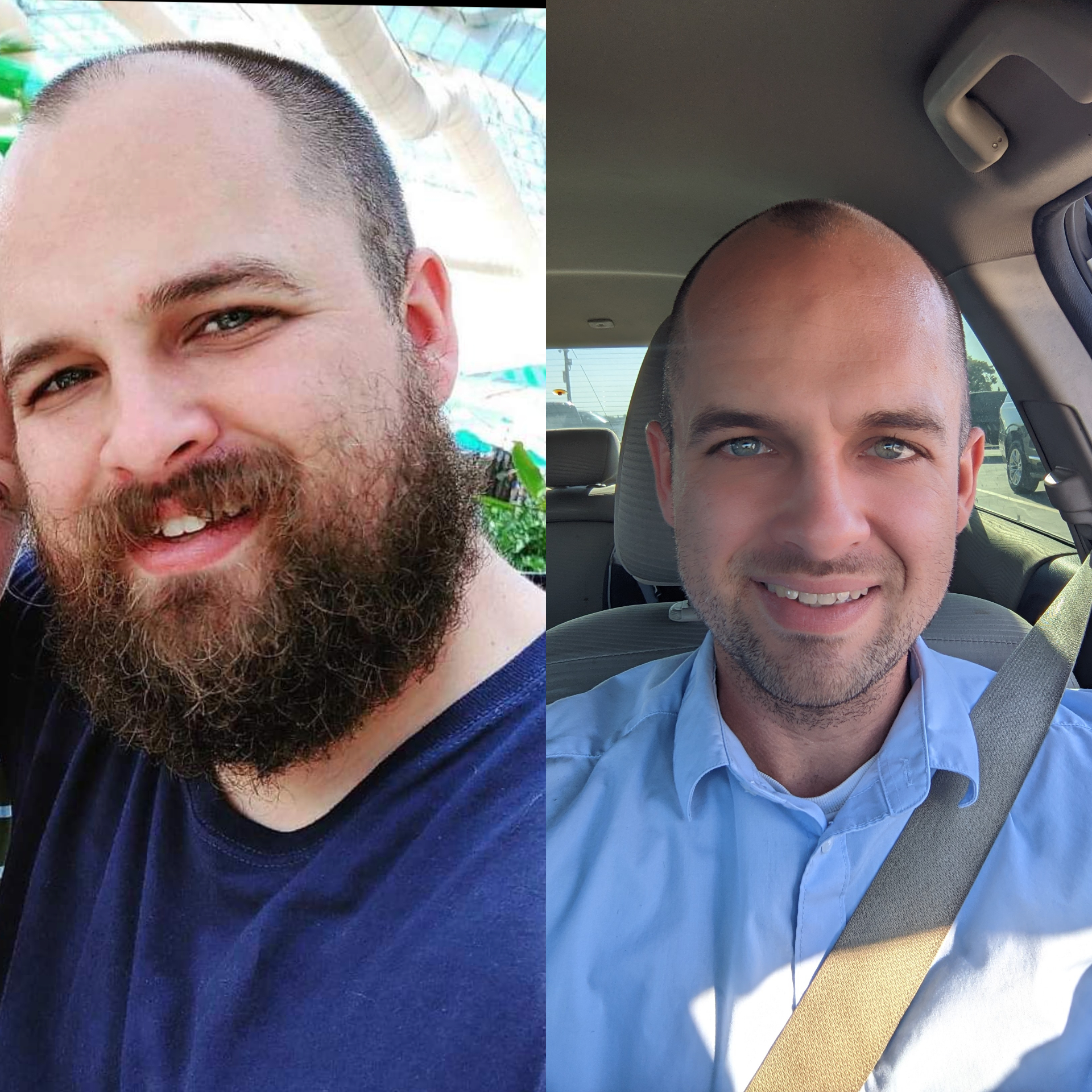 5 foot 8 Male 70 lbs Weight Loss 225 lbs to 155 lbs