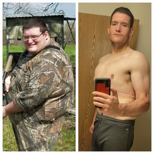 A picture of a 6'3" male showing a weight loss from 460 pounds to 210 pounds. A net loss of 250 pounds.