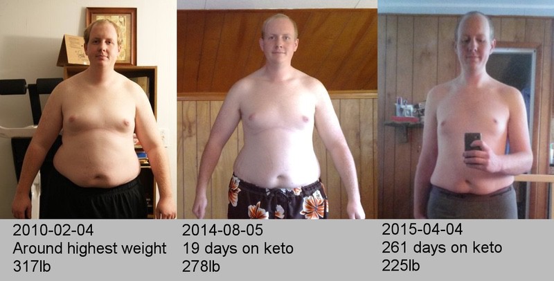 6 feet 4 Male 94 lbs Weight Loss 319 lbs to 225 lbs