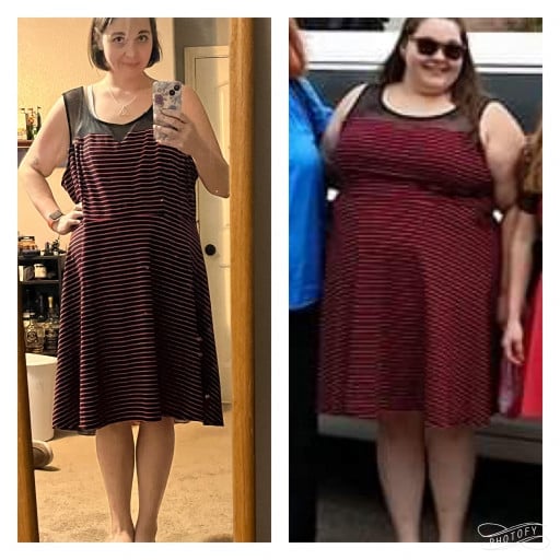 A before and after photo of a 5'6" female showing a weight reduction from 300 pounds to 145 pounds. A total loss of 155 pounds.