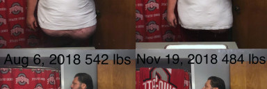 58 lbs Weight Loss Before and After 6 foot 1 Male 542 lbs to 484 lbs