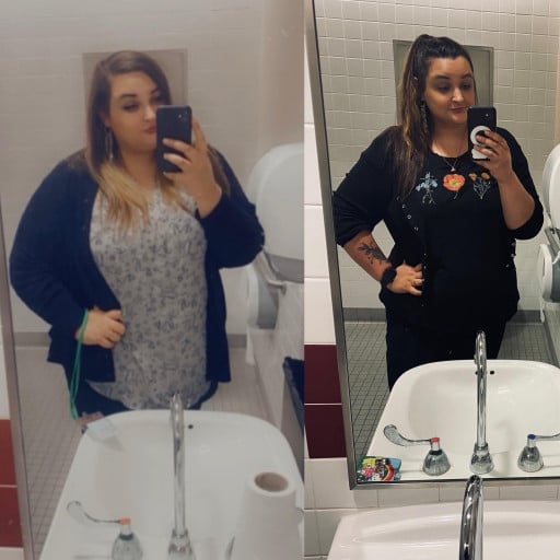 A before and after photo of a 5'11" female showing a weight reduction from 398 pounds to 270 pounds. A net loss of 128 pounds.