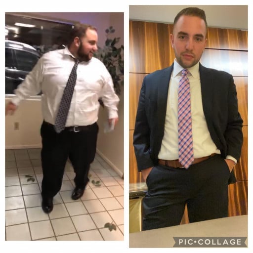 A before and after photo of a 5'10" male showing a weight reduction from 384 pounds to 212 pounds. A net loss of 172 pounds.
