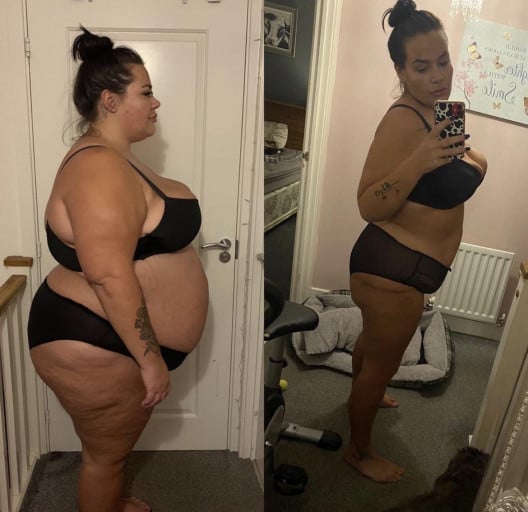 A before and after photo of a 5'5" female showing a weight reduction from 420 pounds to 200 pounds. A net loss of 220 pounds.