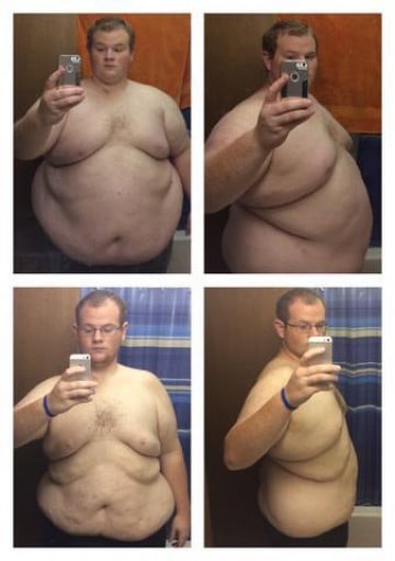 A before and after photo of a 5'11" male showing a weight reduction from 500 pounds to 326 pounds. A respectable loss of 174 pounds.