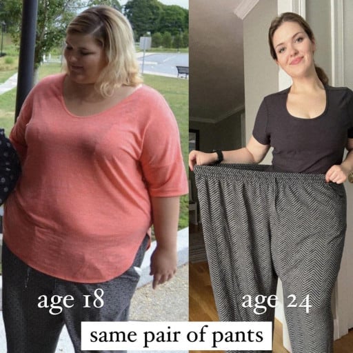 A before and after photo of a 5'6" female showing a weight reduction from 350 pounds to 190 pounds. A net loss of 160 pounds.