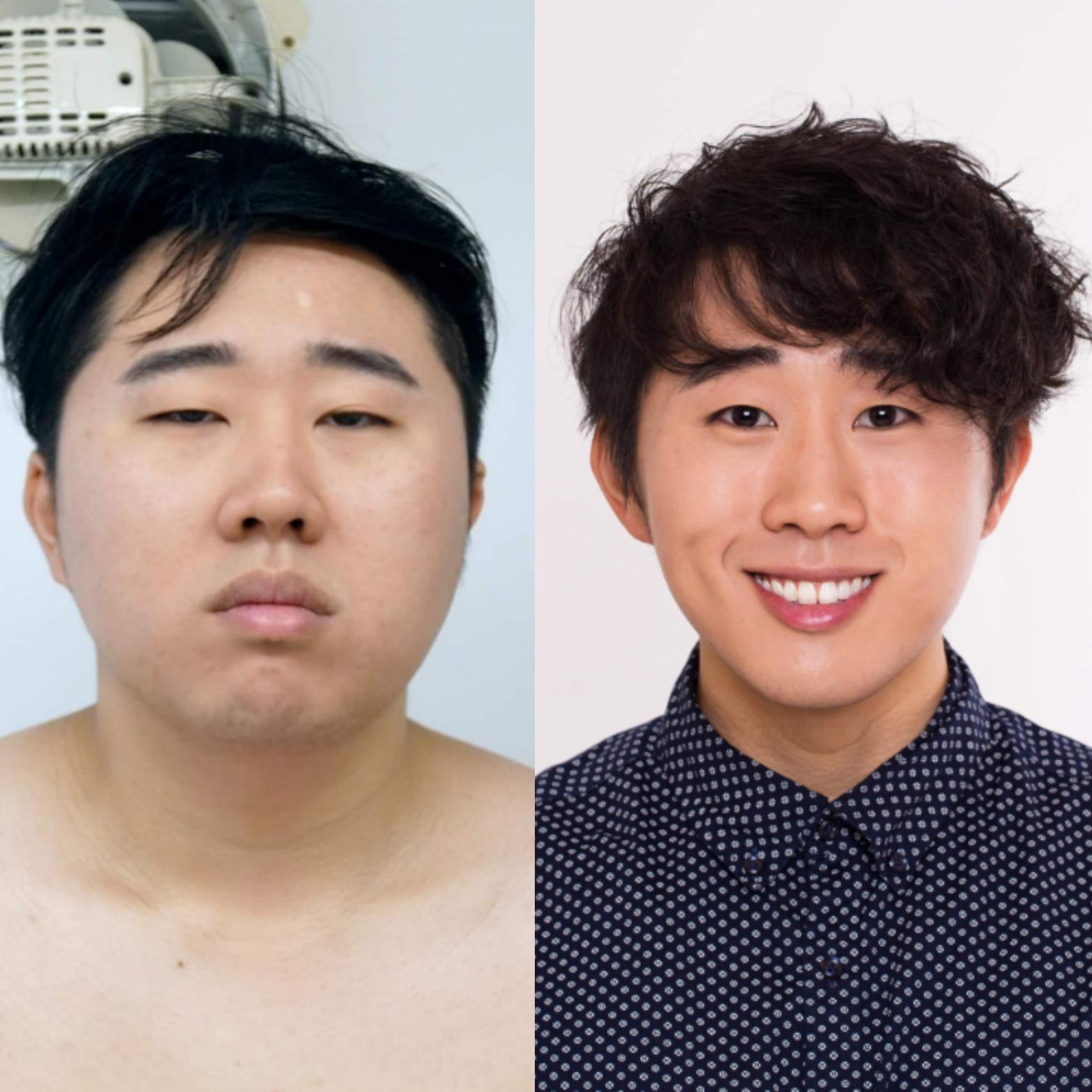Before and After 77 lbs Fat Loss 5'10 Male 236 lbs to 159 lbs