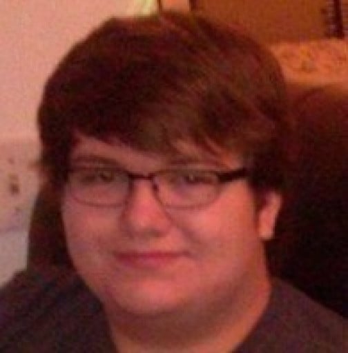 M/18/6'2" [314>275 = 39]Lbs, (5 months) Face Progress, sorry for potato quality in first picture, I didn't take many photos back then.