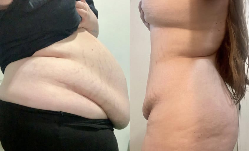 82 lbs Fat Loss 5'8 Female 332 lbs to 250 lbs