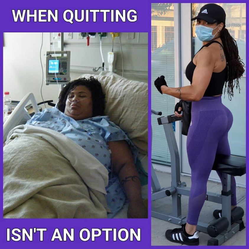 149 lbs Weight Loss Before and After 5'5 Female 389 lbs to 240 lbs