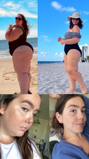 A picture of a 5'5" female showing a weight loss from 380 pounds to 190 pounds. A respectable loss of 190 pounds.
