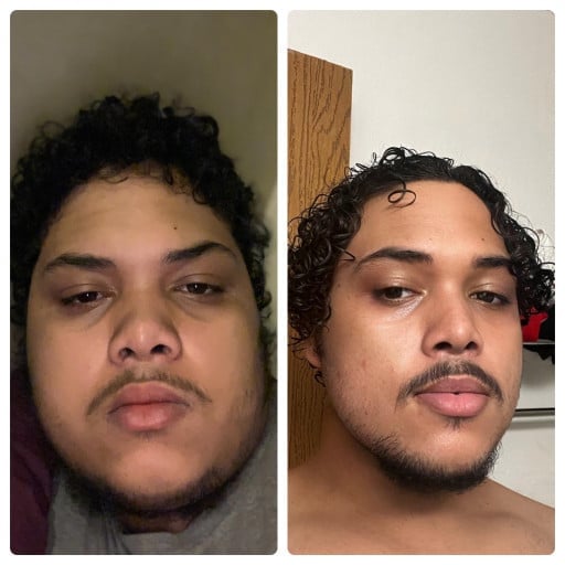 A before and after photo of a 5'11" male showing a weight reduction from 380 pounds to 264 pounds. A respectable loss of 116 pounds.