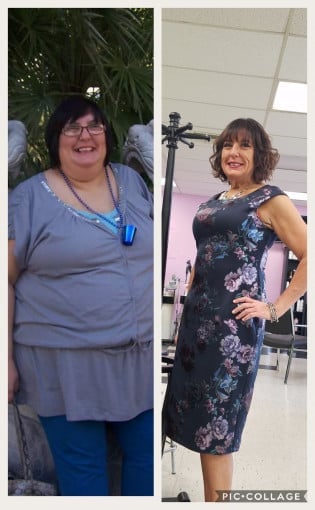 A picture of a 5'5" female showing a weight loss from 316 pounds to 155 pounds. A net loss of 161 pounds.