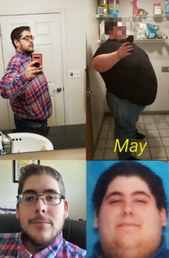 A before and after photo of a 5'11" male showing a weight reduction from 620 pounds to 308 pounds. A respectable loss of 312 pounds.