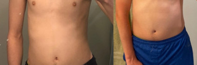 Progress Pics of 55 lbs Muscle Gain 6 feet 3 Male 140 lbs to 195 lbs