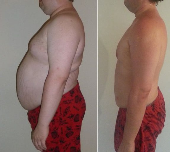 A picture of a 6'3" male showing a weight loss from 320 pounds to 218 pounds. A respectable loss of 102 pounds.
