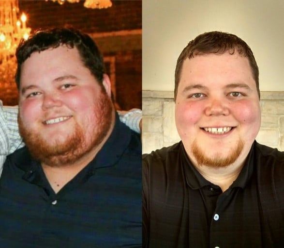A progress pic of a person at 413 lbs