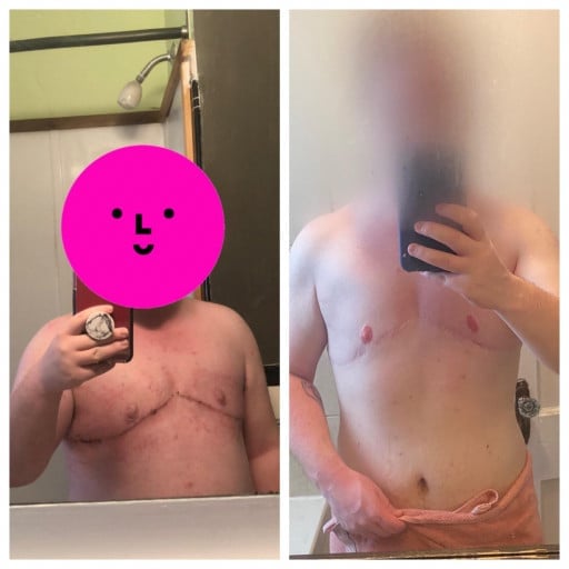 A before and after photo of a 5'4" male showing a weight reduction from 230 pounds to 170 pounds. A net loss of 60 pounds.