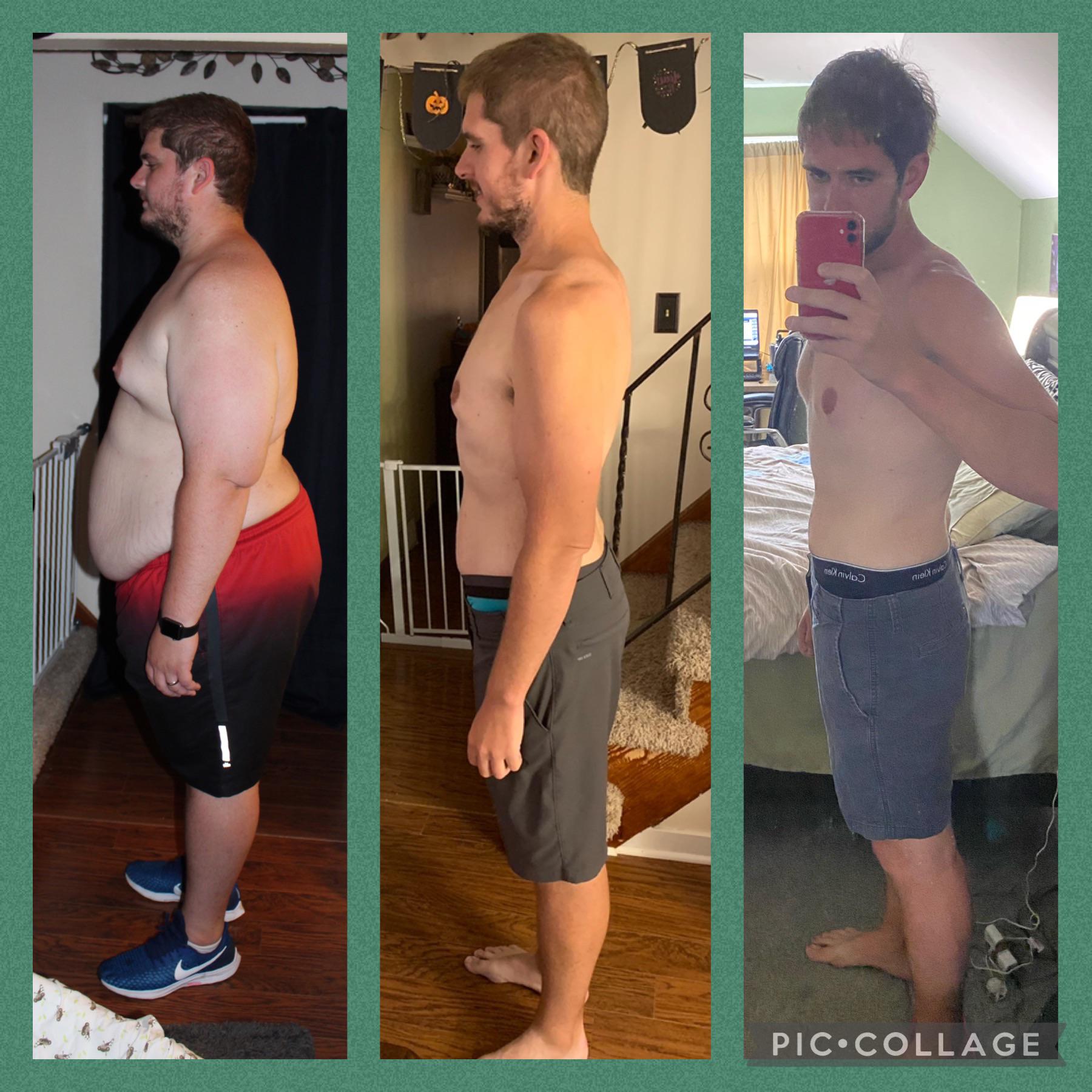 6 feet 1 Male 190 lbs Weight Loss Before and After 378 lbs to 188 lbs