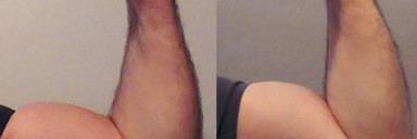 5'10 Male Before and After 15 lbs Fat Loss 200 lbs to 185 lbs