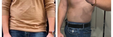 6 foot 6 Male Before and After 60 lbs Fat Loss 285 lbs to 225 lbs