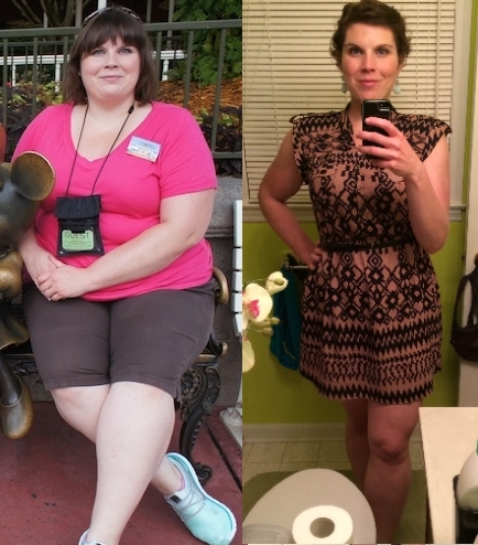5 feet 9 Female 141 lbs Fat Loss Before and After 317 lbs to 176 lbs