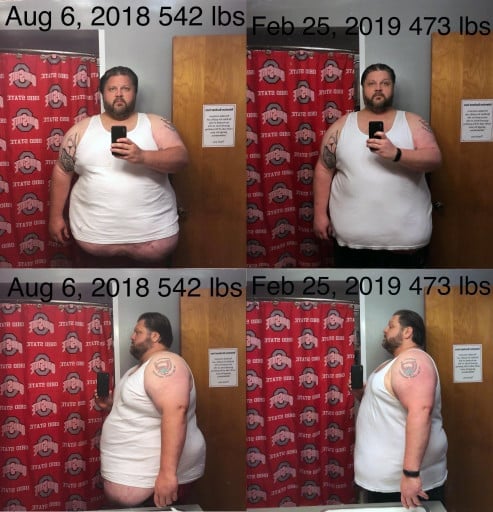 69 lbs Fat Loss Before and After 6 foot 1 Male 542 lbs to 473 lbs
