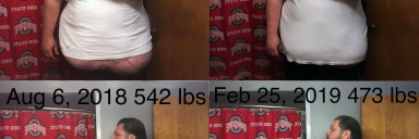 69 lbs Fat Loss Before and After 6 foot 1 Male 542 lbs to 473 lbs