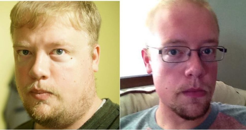 A picture of a 6'3" male showing a weight loss from 375 pounds to 252 pounds. A net loss of 123 pounds.