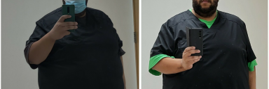 Before and After 55 lbs Fat Loss 5 foot 10 Male 420 lbs to 365 lbs