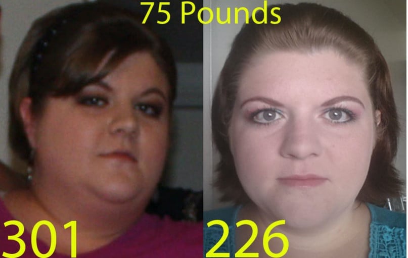 A before and after photo of a 5'6" female showing a weight reduction from 301 pounds to 226 pounds. A total loss of 75 pounds.