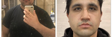 6'2 Male Progress Pics of 70 lbs Fat Loss 330 lbs to 260 lbs