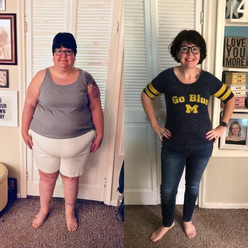 A before and after photo of a 5'4" female showing a weight reduction from 331 pounds to 172 pounds. A net loss of 159 pounds.