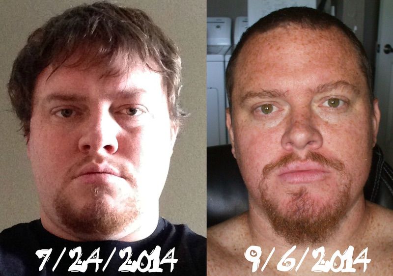 6 feet 2 Male 54 lbs Weight Loss Before and After 410 lbs to 356 lbs