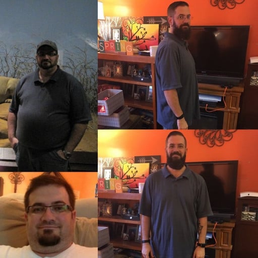 A progress pic of a 5'10" man showing a fat loss from 299 pounds to 199 pounds. A net loss of 100 pounds.
