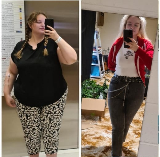 110 lbs Weight Loss Before and After 5 feet 9 Female 284 lbs to 174 lbs