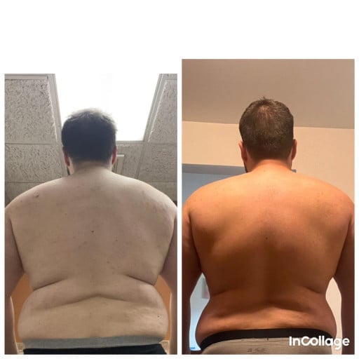 A before and after photo of a 6'3" male showing a weight reduction from 320 pounds to 270 pounds. A net loss of 50 pounds.