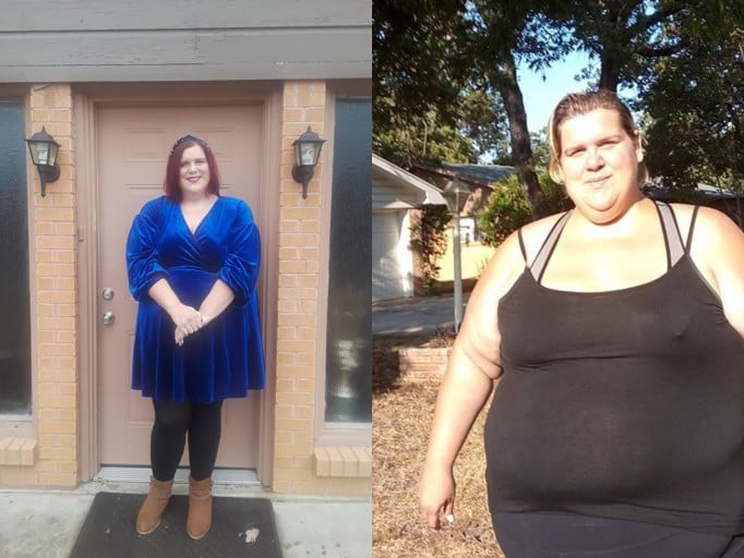 A picture of a 5'10" female showing a weight loss from 478 pounds to 377 pounds. A net loss of 101 pounds.