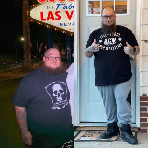 A progress pic of a 5'7" man showing a fat loss from 313 pounds to 263 pounds. A net loss of 50 pounds.