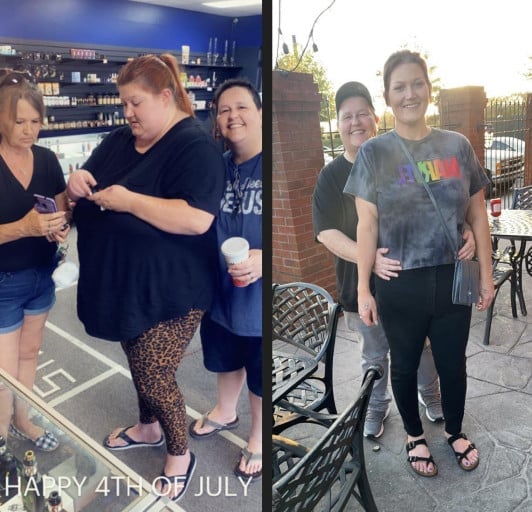 F/35/5’9 [401 > 185 = 216] [15 months] I had vertical sleeve gastrectomy 25lbs from my personal goal.