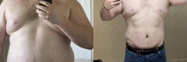 6'1 Male 66 lbs Fat Loss Before and After 356 lbs to 290 lbs